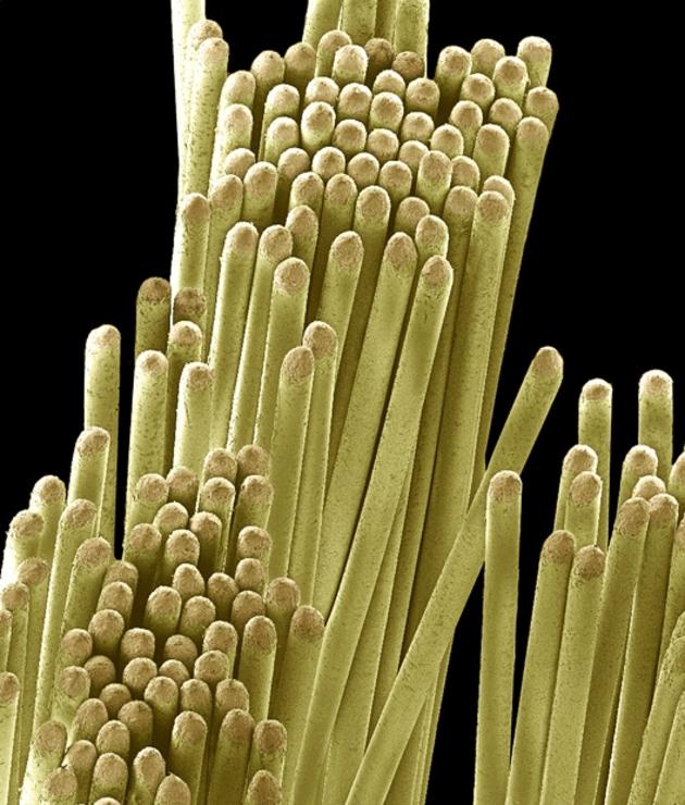 Toothbrush magnified